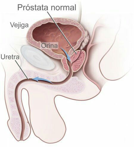 MASAJE ANAL PROSTATICO CON BESO NEGRO. Y TAMBIÉN CON ALGO MÁS.