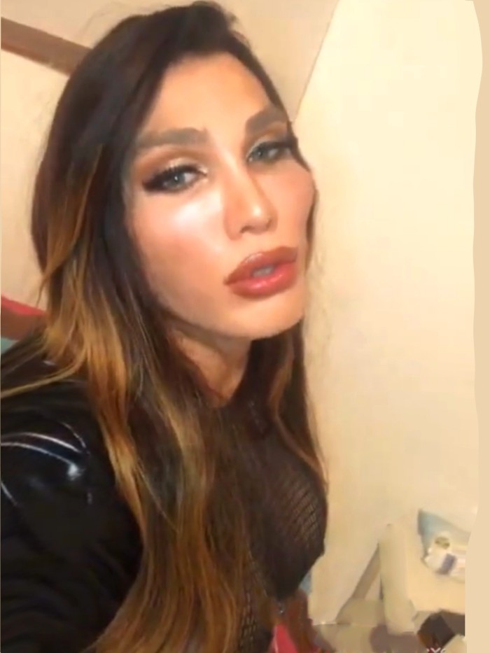 TRANS Barbara cara de zorrita Sexy labios de fresa